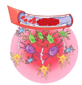 Neuron Excitotoxic Damage